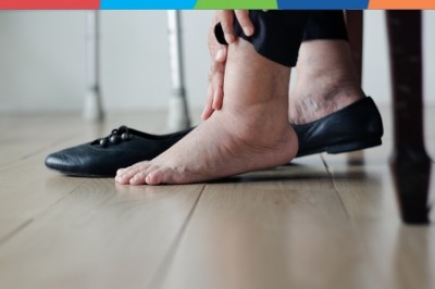 Mâini și picioare umflate? Ai putea avea aceste afecțiuni!